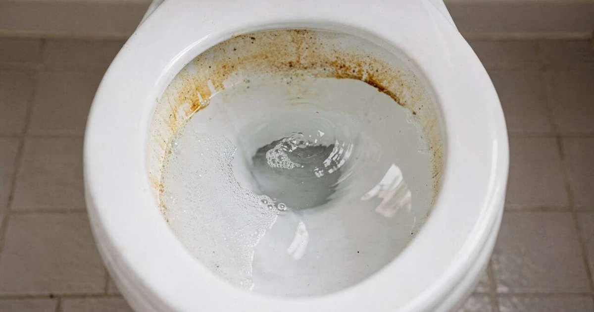 Elimina para siempre las manchas del inodoro con este sencillo truco casero