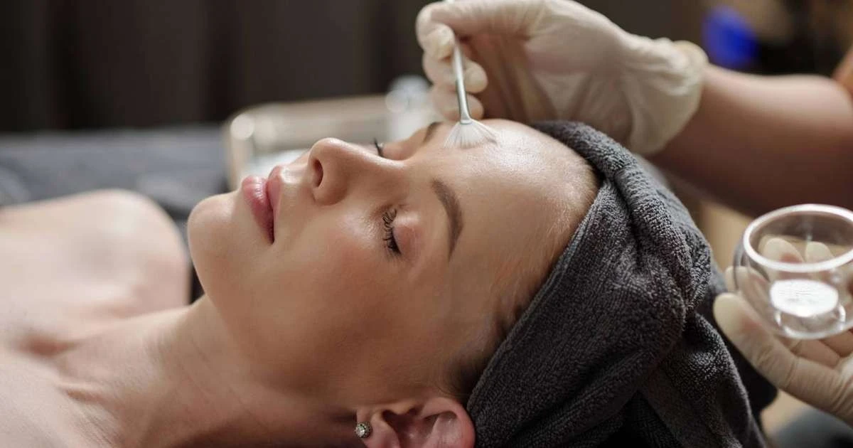Cuánto cuesta el peeling para manchas y acné: presupuestos actualizados 2026